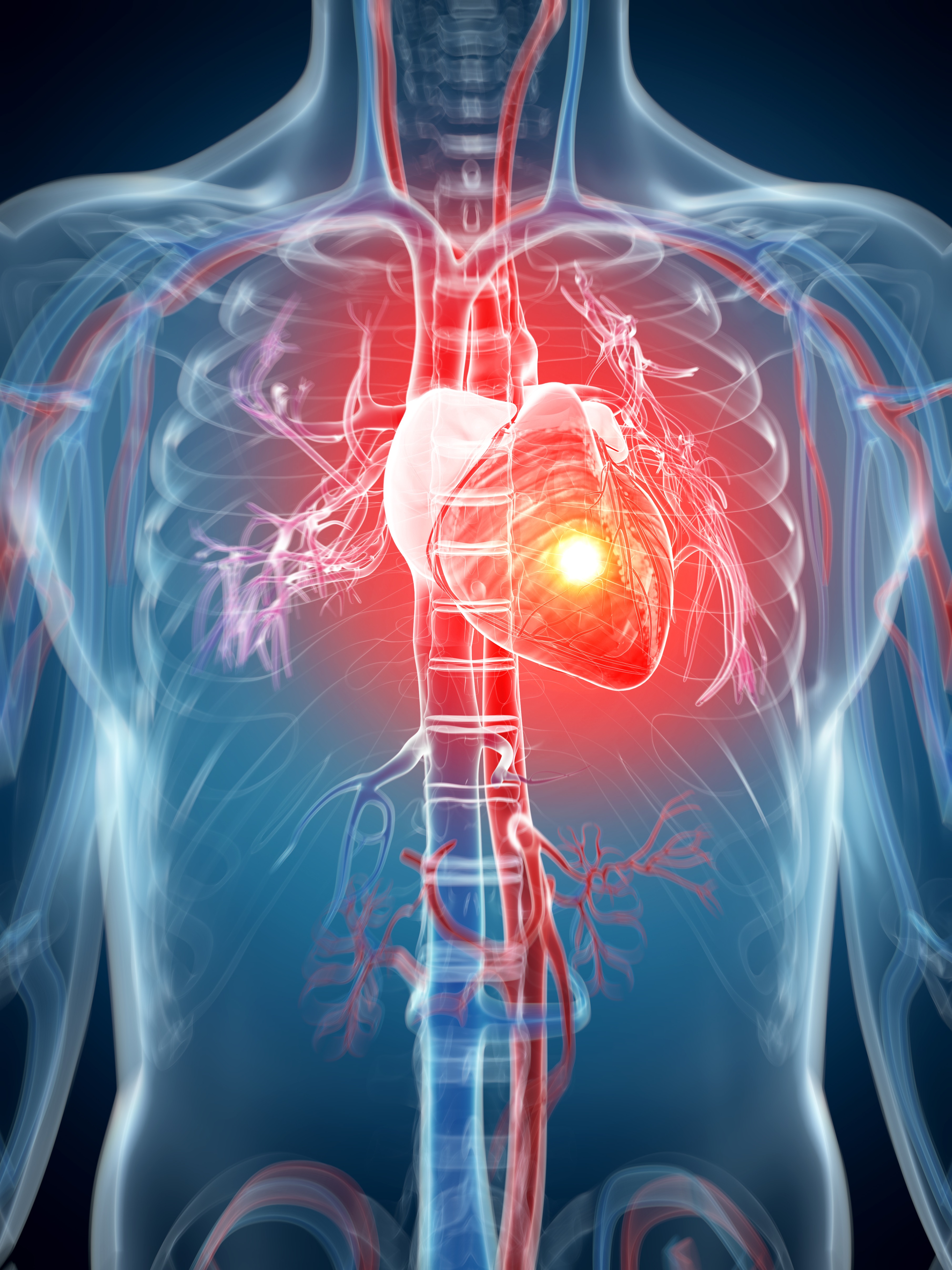 Computer-generated illustration of a human heart during cardiac arrest | Source: Getty Images
