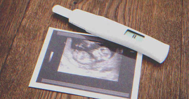 A pregnancy test and an ultrasound scan | Shutterstock