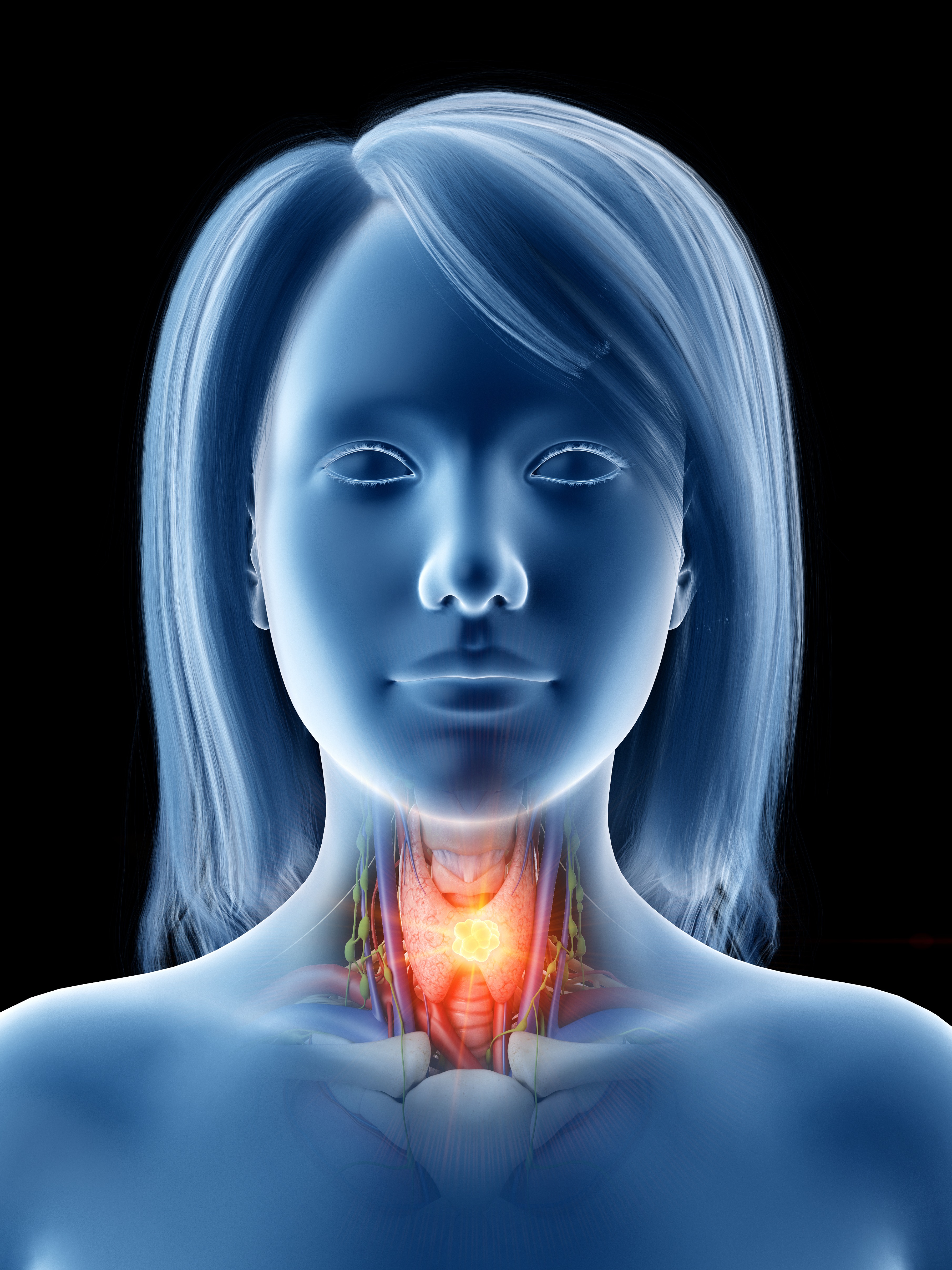 Digital visualization of thyroid cancer showing the affected gland and nearby anatomical structures | Source: Getty Images