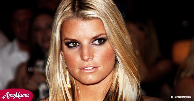 Jessica Simpson causes a wave of criticism after sharing a photo of her rather large lips