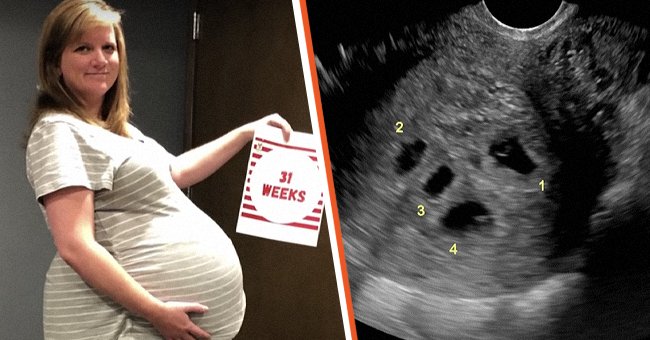 [Left] Megan Hulen 31 weeks pregnant with quintuplets; [Right] A sonogram of quintuplets. | Source: youtube.com/truly