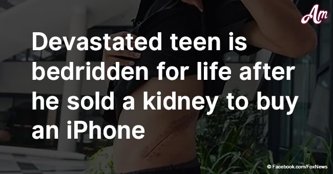 Devastated teen is bedridden for life after he sold a kidney to buy an iPhone
