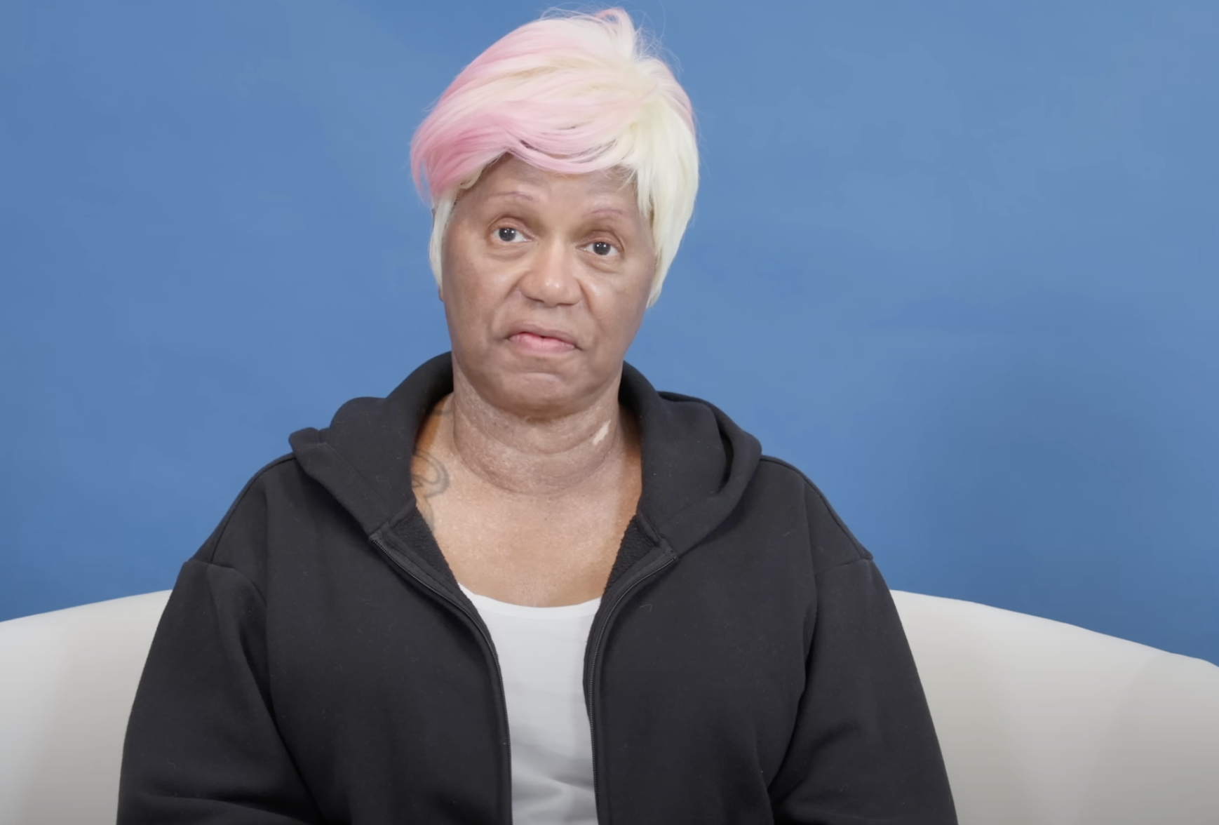 Diana before her facial rejuvenation, dated August 23, 2024 | Source: YouTube/@Dr.Truesdale