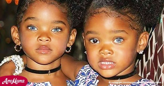 Ces petites filles ont été proclamées "les plus belles jumelles du monde"