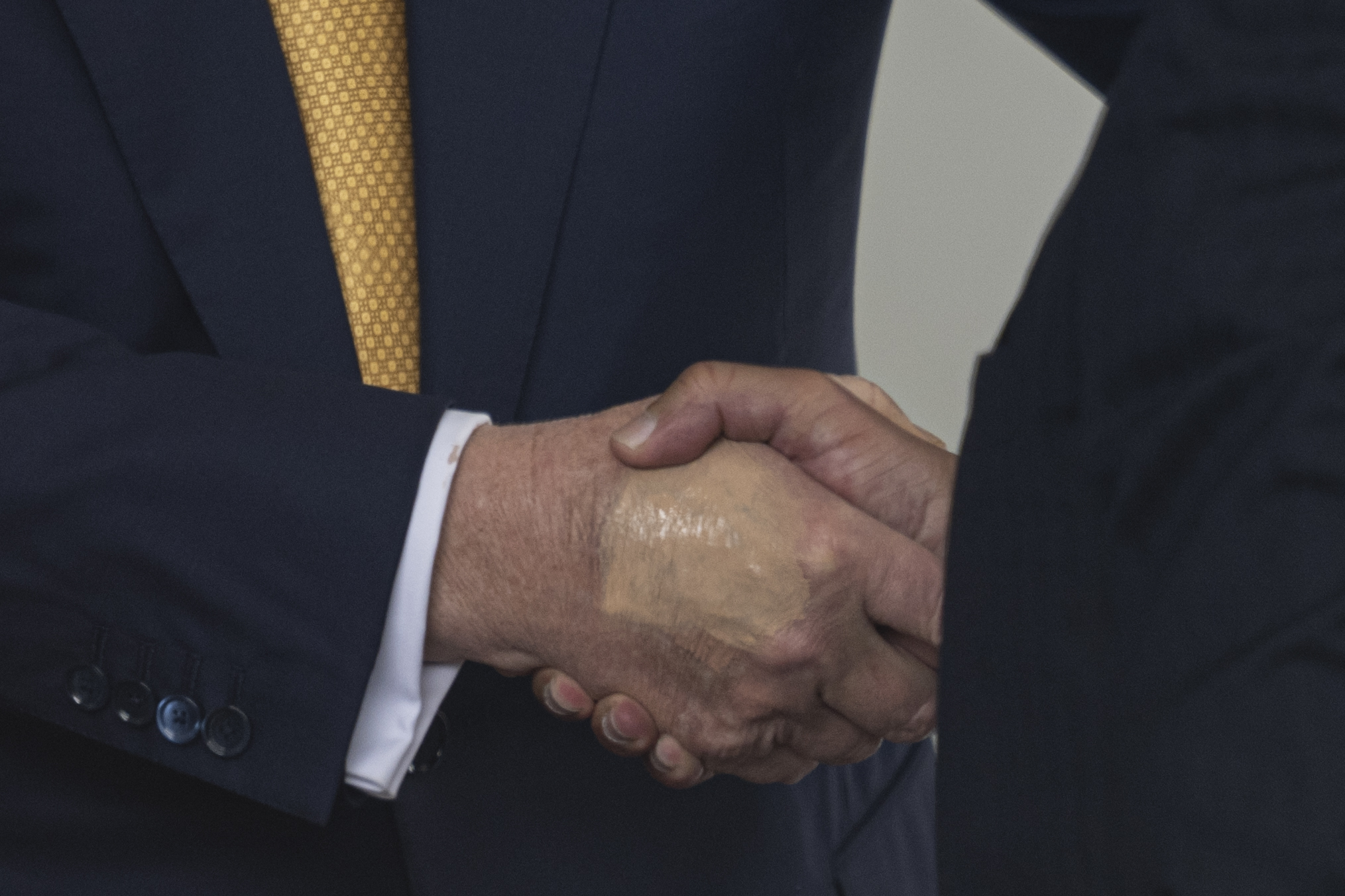 A close-up of Donald Trump's hand while greeting the Crown Prince and Prime Minister of the Kingdom of Bahrain Salman bin Hamad bin Isa Al Khalifa at the White House in Washington, D.C., on July 16, 2025. | Source: Getty Images