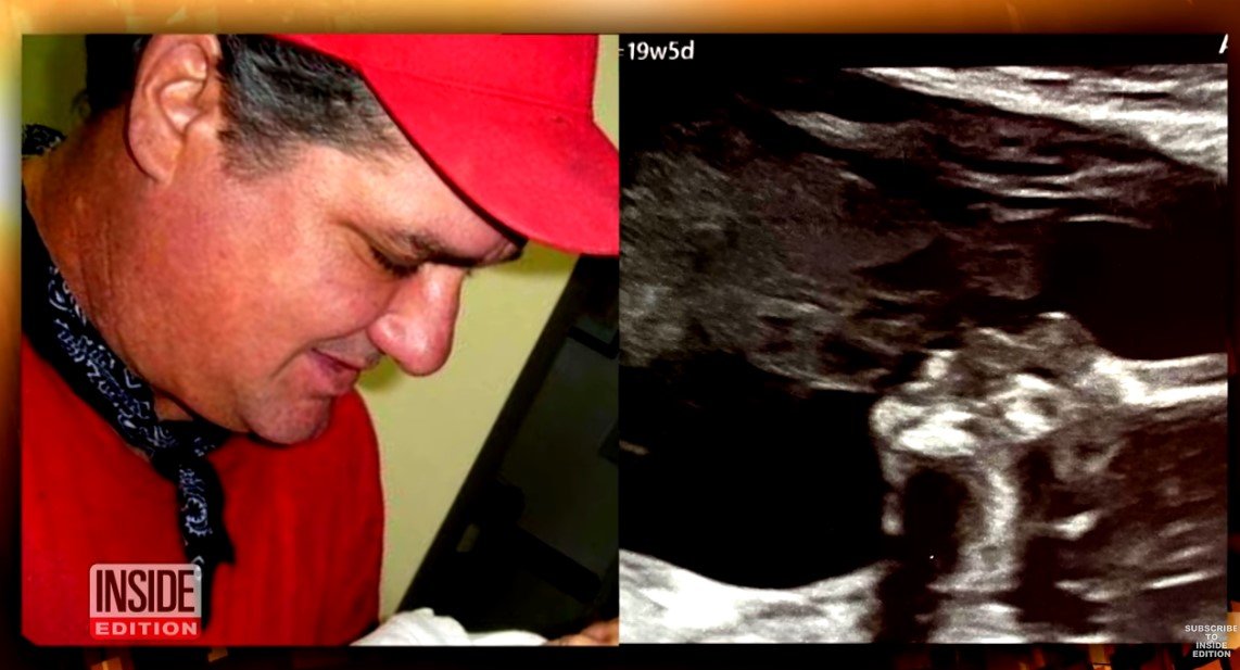 [Left] Picture of Shantel Carrillo's dad holding her first daughter; [Right] Picture of Shantel Carrillo's ultrasound   | Source: Youtube/ Inside Edition