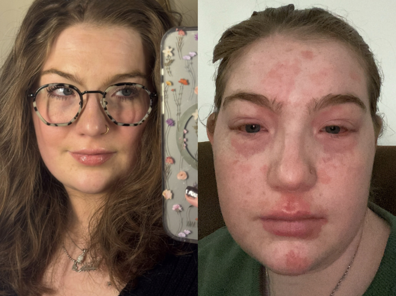 A TikToker's before-and-after photos: single vs. in a relationship. | Source: TikTok/virginiaginger00
