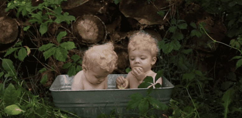  Parents of albino twins relocate to protect them from the sun | Photo: YouTube/SWNS TV