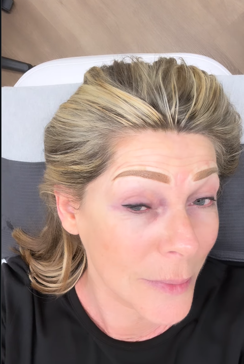 Ruth Langsford after having her eyeline and eyebrow tattoo done | Source: Instagram/ruthlangsford