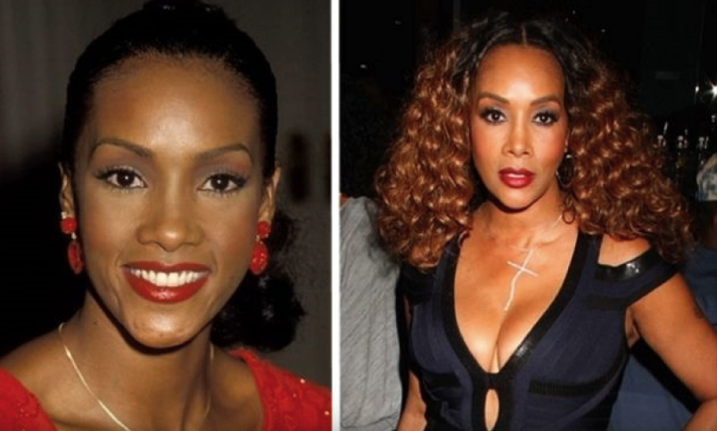 Image Credits: YouTube/Celebrity Plastic Surgery Image Credits: YouTube/Celebrity Plastic Surgery