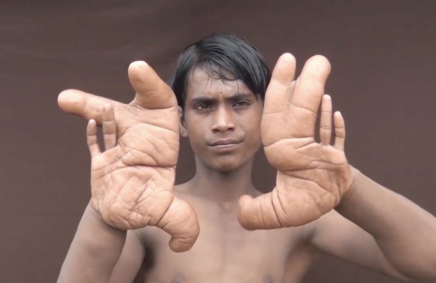Tarik shows his gigantic hands. | Source: facebook.com/100015318133073