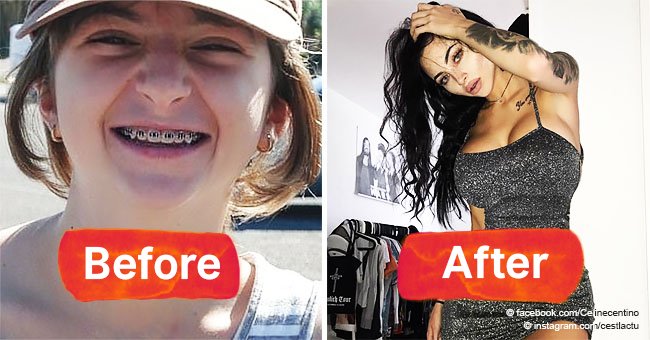 Victim of bullying spent almost $50,000 on surgery and now looks like a new person