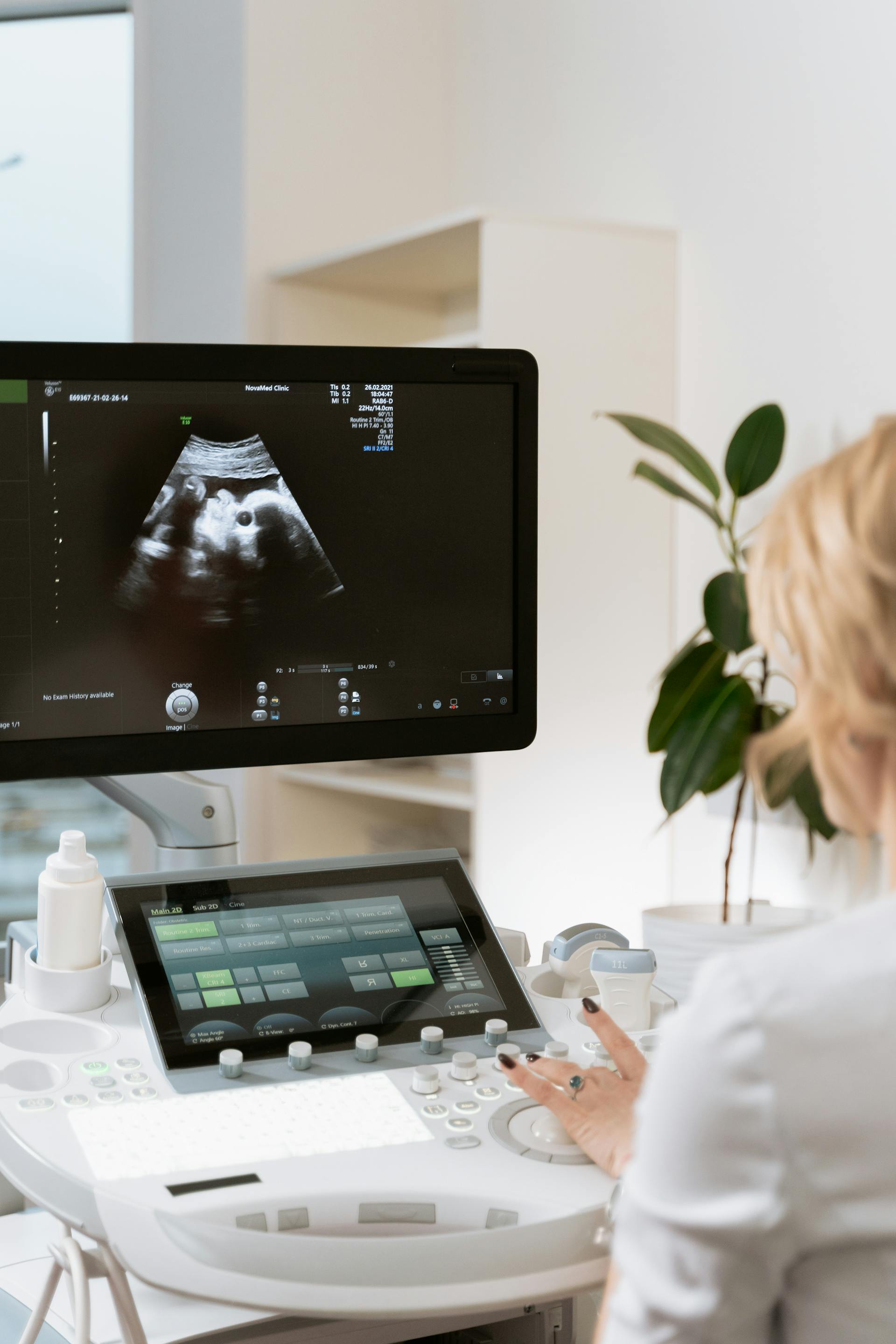 A person having an ultrasound | Source: Pexels