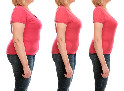 Une femme qui a perdu beaucoup de poids | Photo : Shutterstock