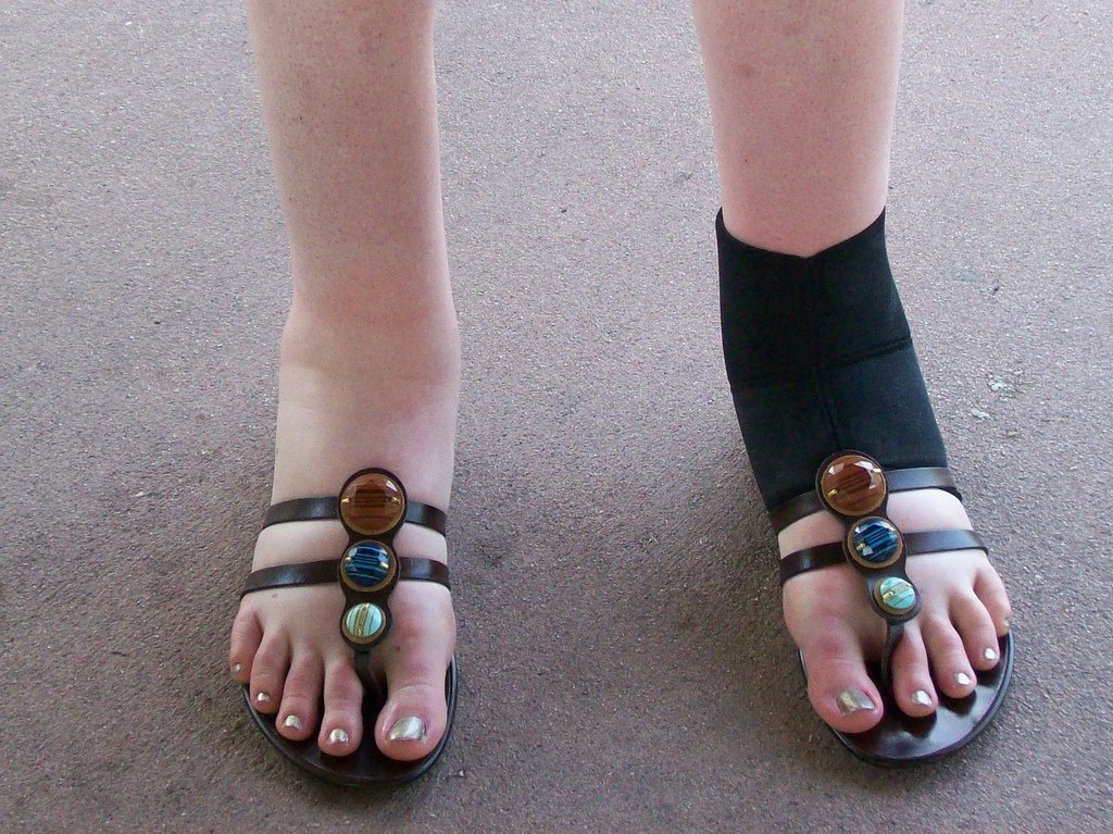 Pies inflamados. | Foto: Flickr