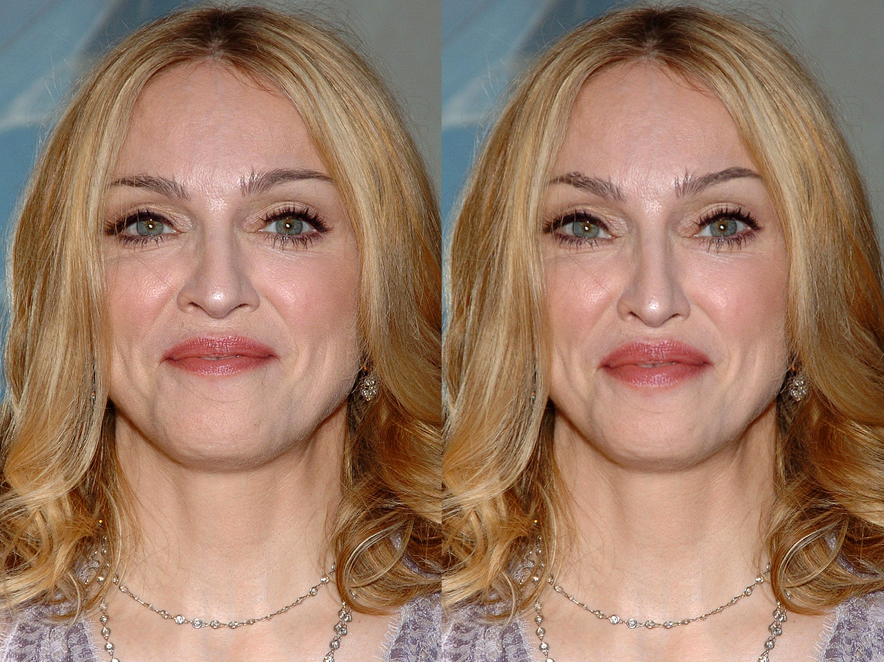 Madonna vs how she would look with the Golden Ratio | Source: Getty Images