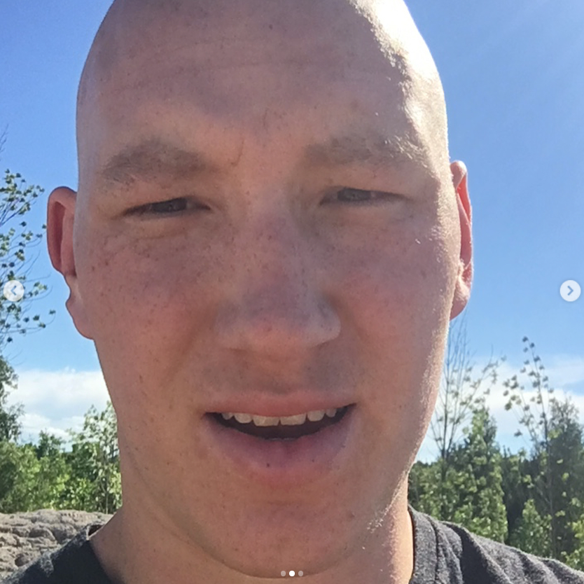 Rex Culpepper during his cancer treatment | Source: Instagram/rex_culpep