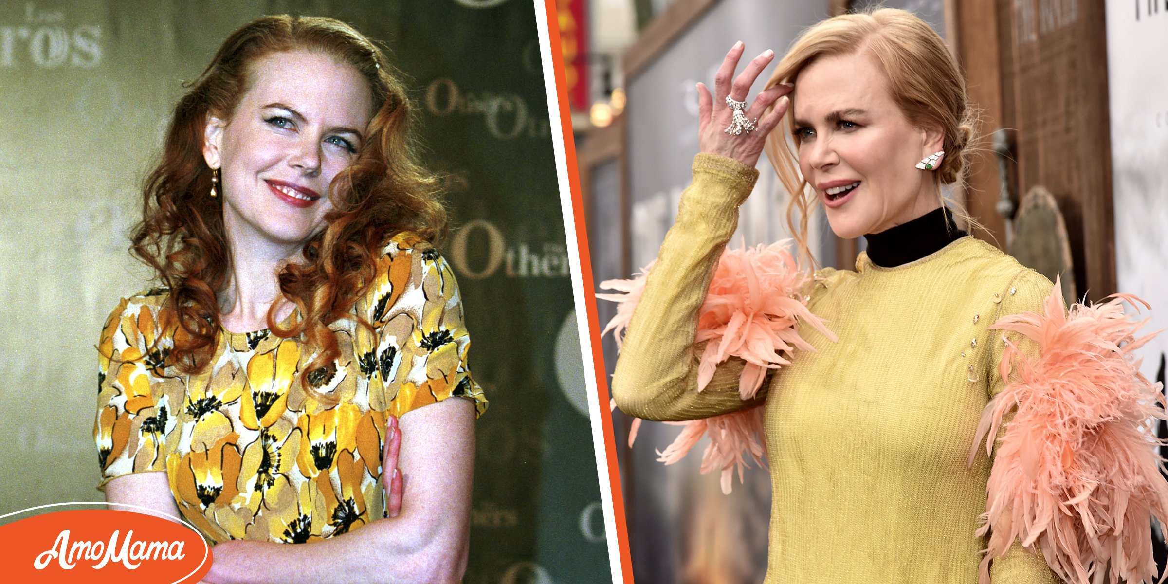 Has Nicole Kidman Had Plastic Surgery? The Actress's Face Has Been