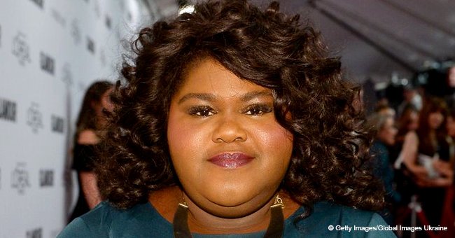 Gabby Sidibe flaunts her thinner body in Mickey Mouse T-shirt & sunglasses days after her surgery