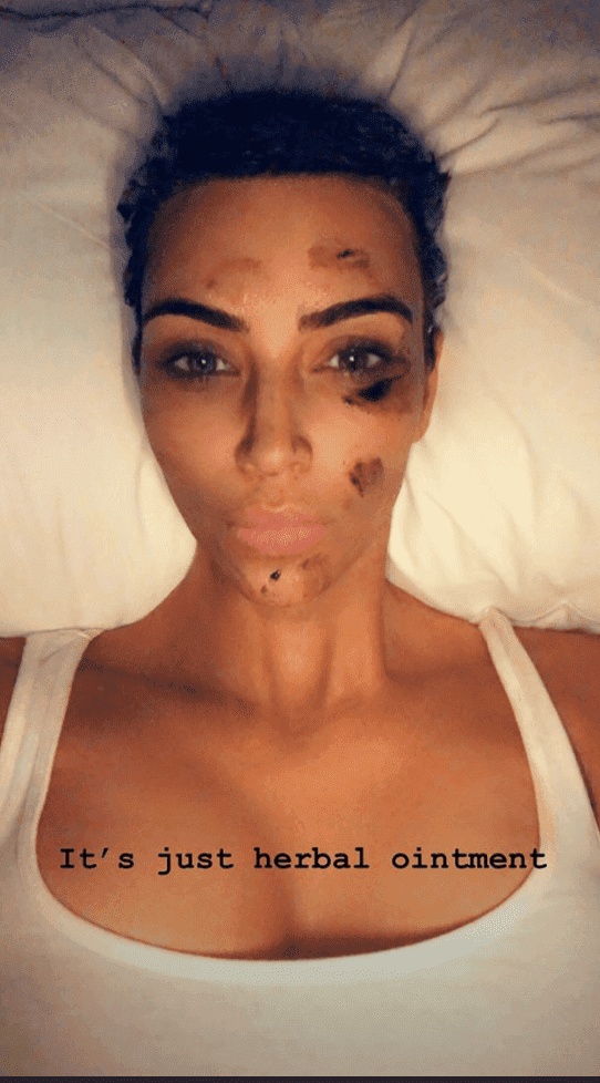 Kim Kardashian with herbal ointment on her face | Source: Instagram Stories/Kim Kardashian