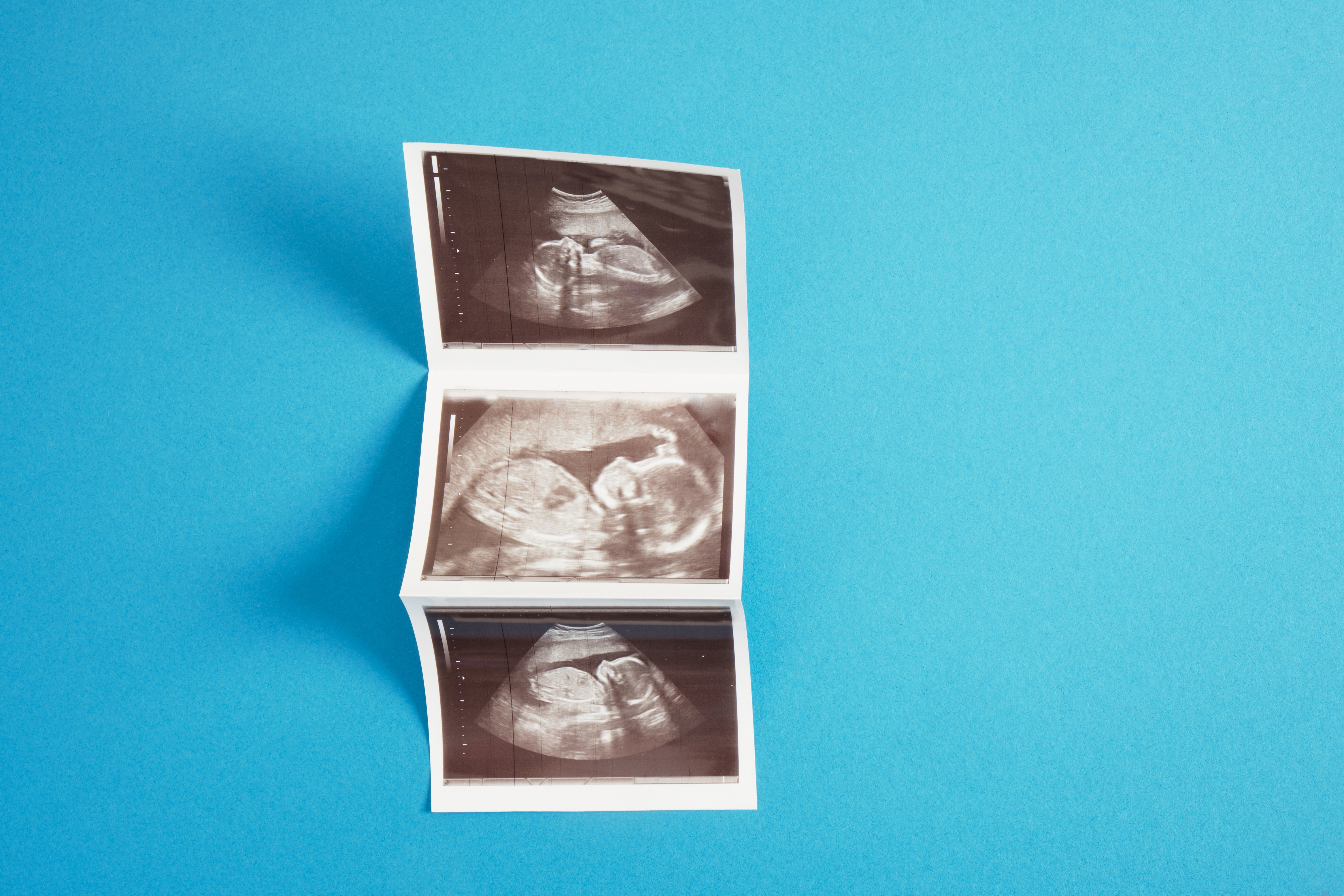 Ultrasound picture | Source: Shutterstock