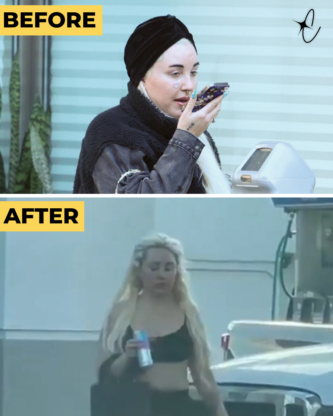 BEFORE: Amanda Bynes was spotted in Beverly Hills, California in 2024 | AFTER: Seen at a gas station in 2026 | Source: Getty Images | X/TMZ