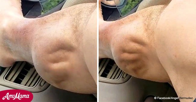 Video shows intense muscle cramps in man's calf