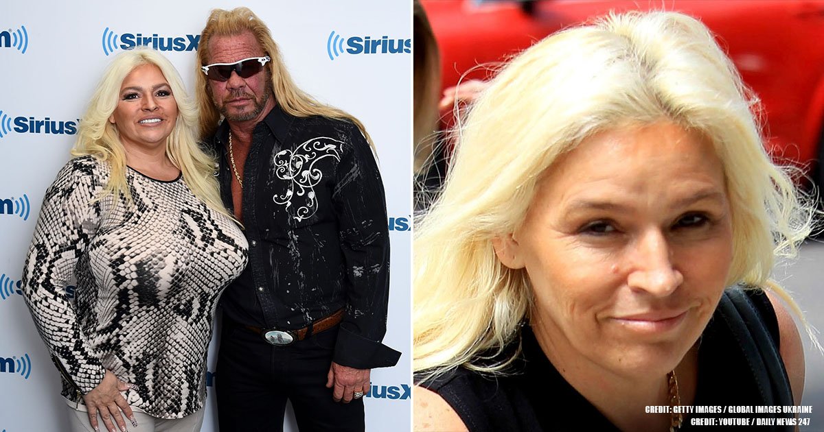 beth chapman weight loss