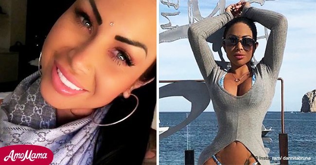Model left partially blind after controversial surgery to change eye color to light gray