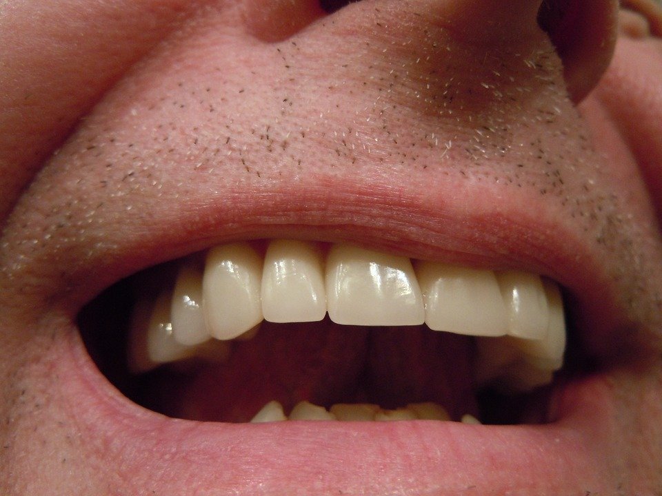 Hombre mostrando su dentadura. | Imagen: Pixabay
