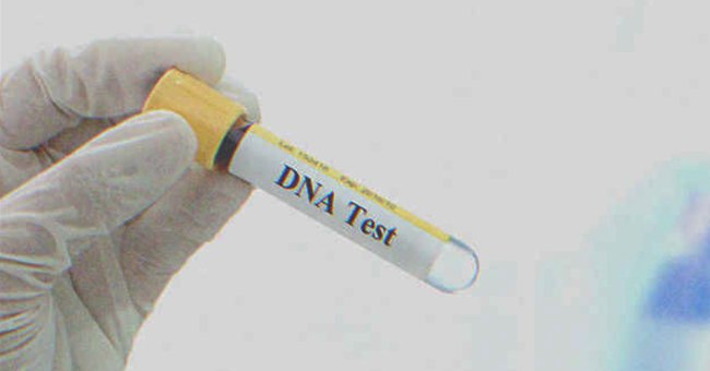 Dna test | Source: Shutterstock