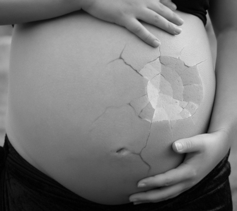 Mujer embarazada | Foto: Pixabay