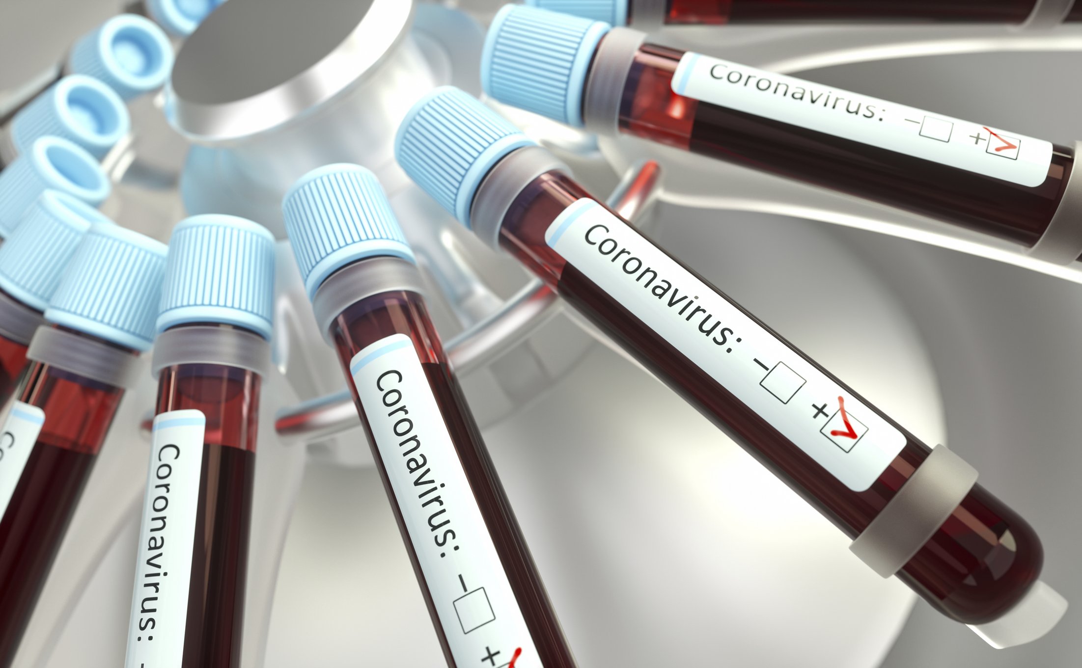 Investigación sobre el Coronavirus, ilustración conceptual.| Foto: Getty Images Investigación sobre el Coronavirus, ilustración conceptual.| Foto: Getty Images
