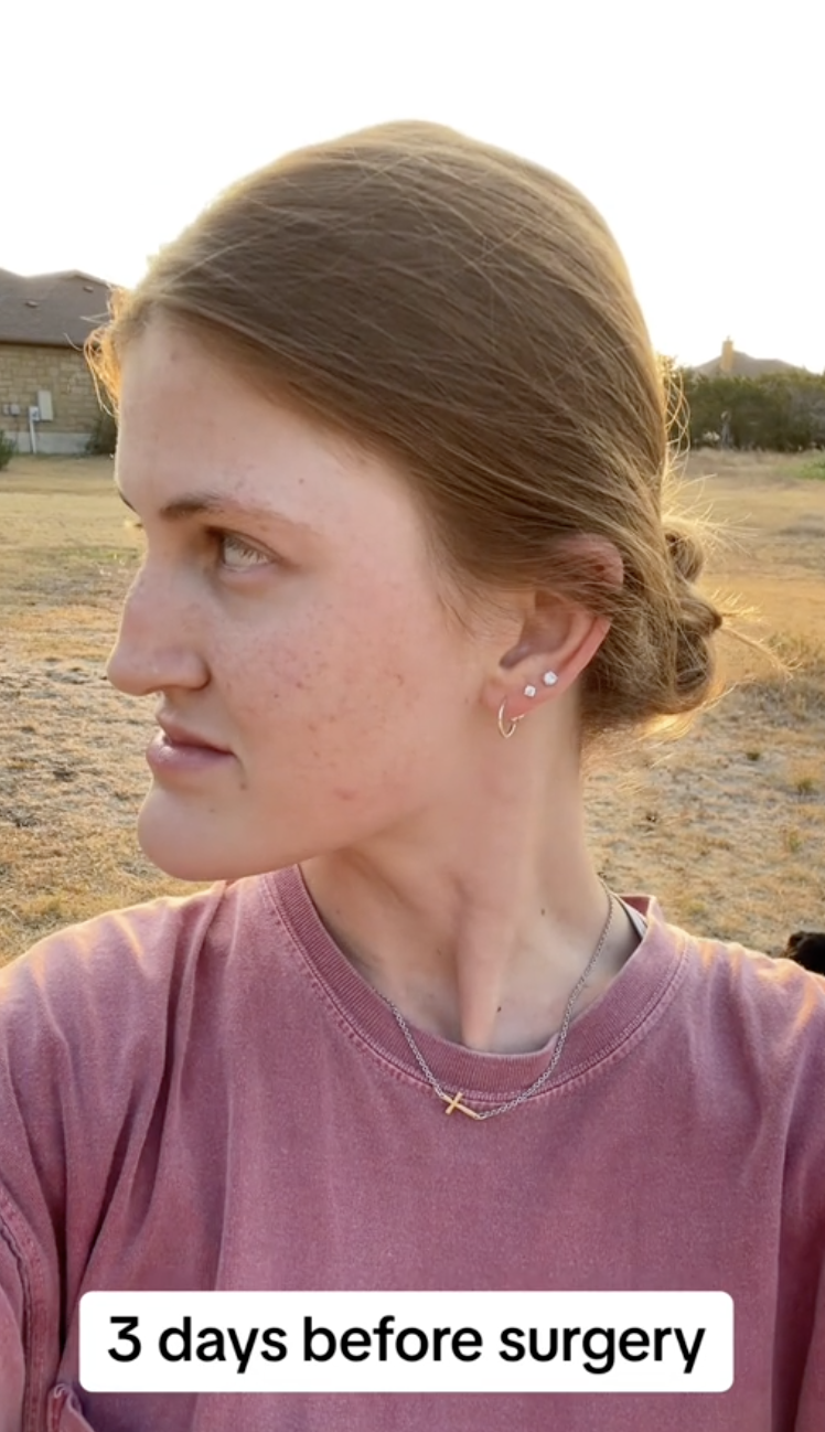 Virginia Elder turns to the right, showing the shape of her natural jaw. | Source: TikTok/virginiaeelder