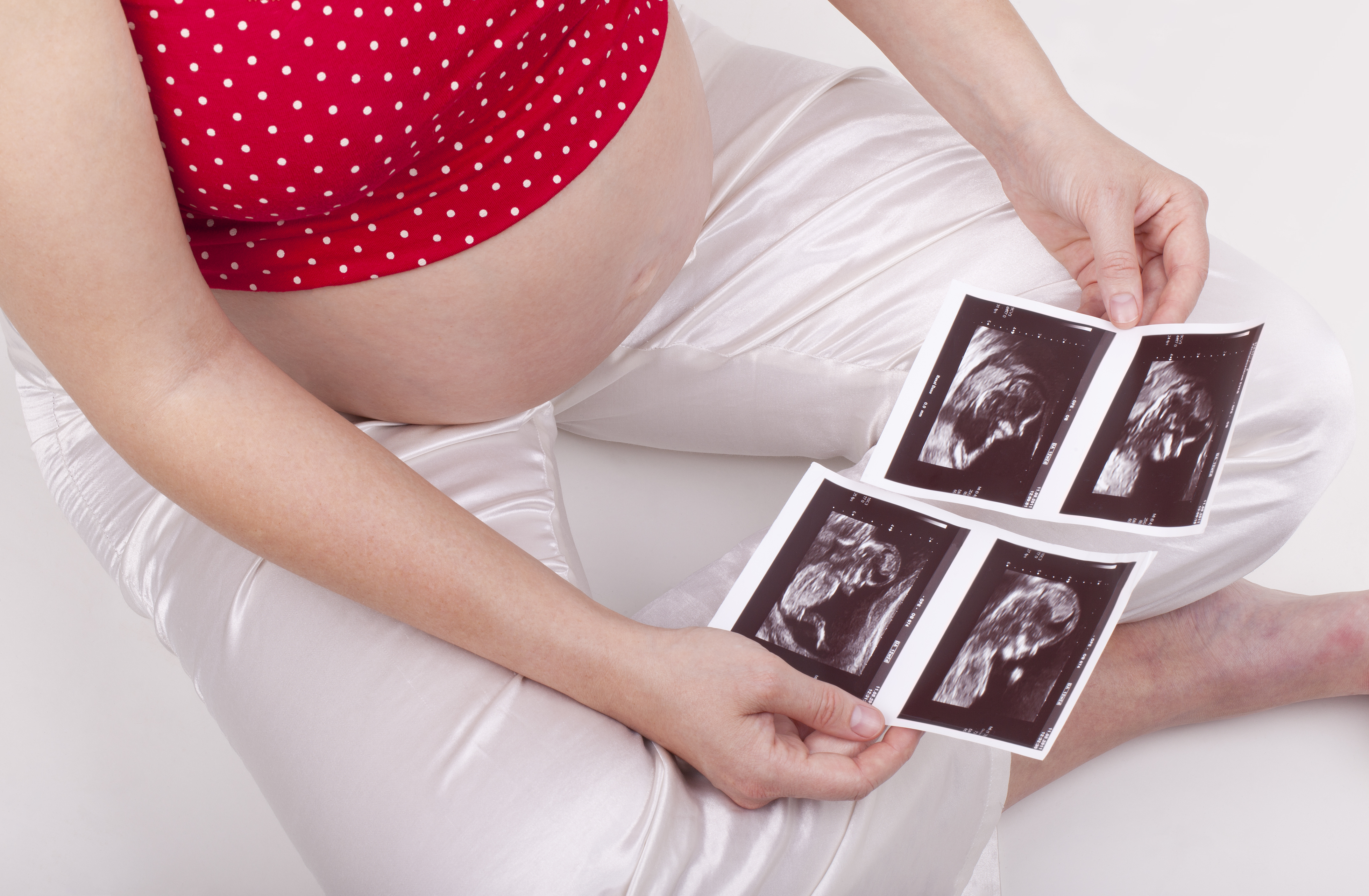 A pregnant woman holding sonogram | Source: Shutterstock