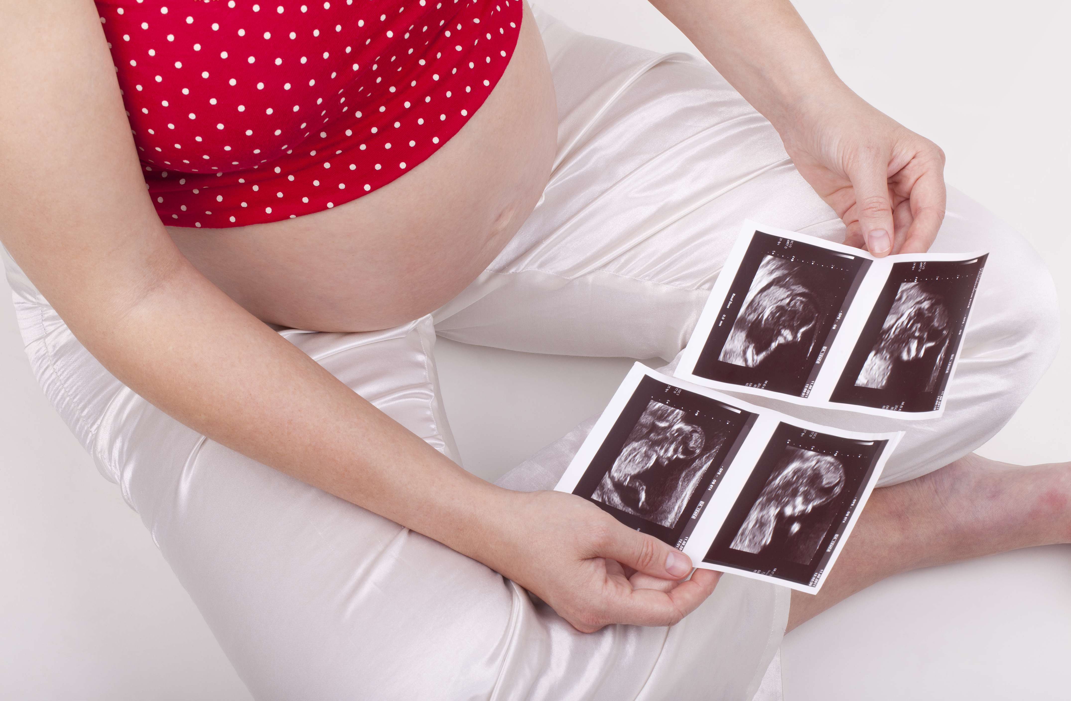 A pregnant woman holding  sonogram | Source: Shutterstock