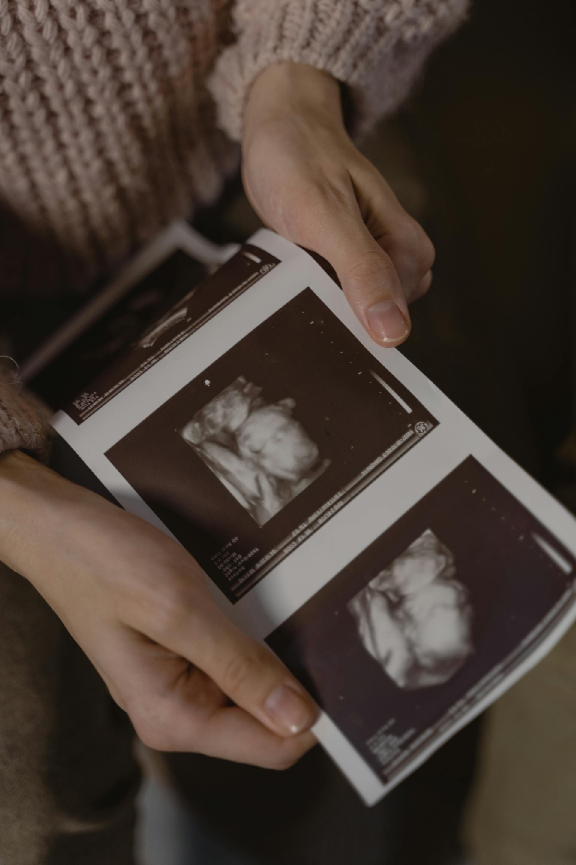 A woman holding an ultrasound photo | Source: Pexels