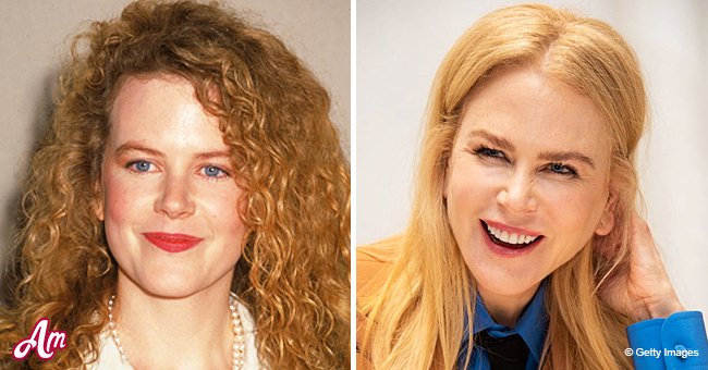 Nicole Kidman Looks Aged-Defying at 53 — Look inside Her Facial