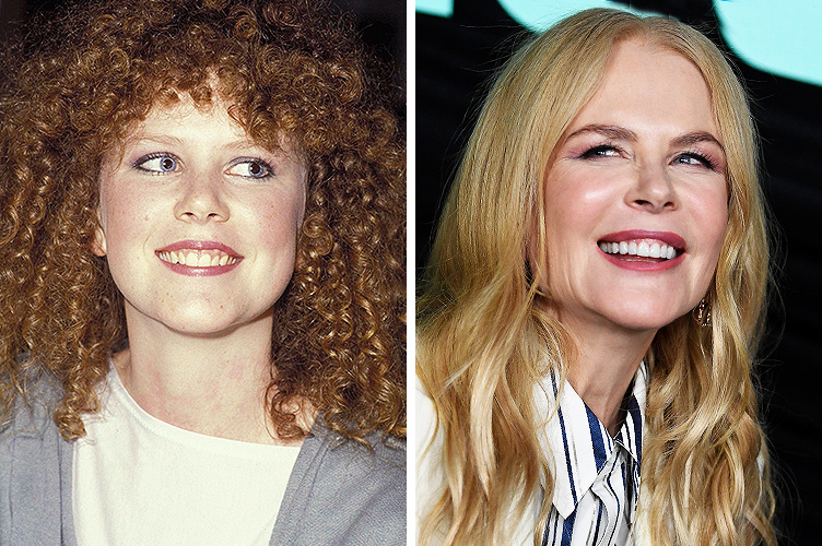 Nicole Kidman, December 1, 1983 | Nicole Kidman, October 13, 2019 | Source: Getty Images