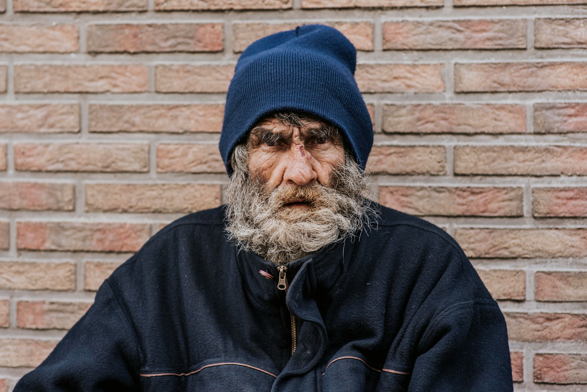 A stressed-out homeless man | Source: Freepik