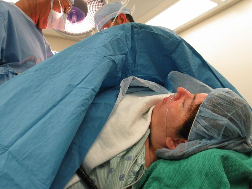 A c-section birth. | Photo: Flickr/ Margaret Erlandson