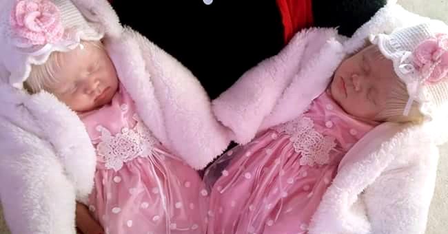 Albino-Zwillinge, Catalina und Virginia. | Quelle: Facebook.com/cabezonpaz