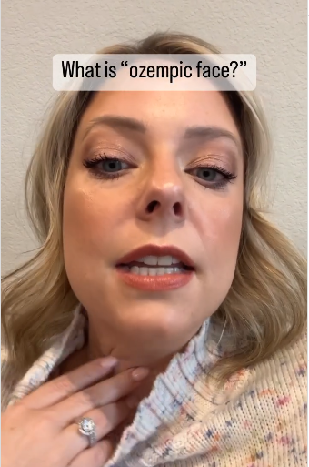 Natasha Robinsons shows her wrinkled neck in a post dated February 2, 2023 | Source: Instagram/millennialrandom