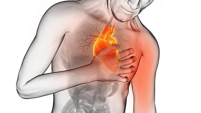 Dibujo representativo de un ataque cardiaco | Foto: Flickr