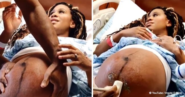 Doctor was forced to turn a baby over inside the mother’s womb for a safe delivery