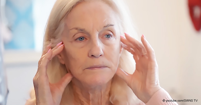"Me veré bonita en mi ataúd": Abuela de 80 años arriesgó su vida por un estiramiento facial 
