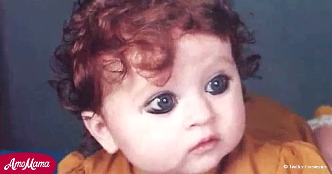 Red haired Indian girl was called a monster, but 20 years later she looks unrecognizable