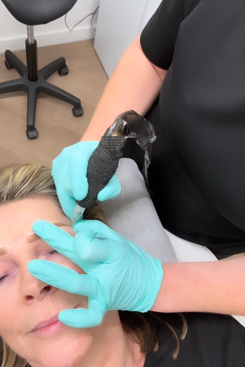 TV personality Ruth Langsford having her eyebrow tattoo done | Source: Instagram/ruthlangsford