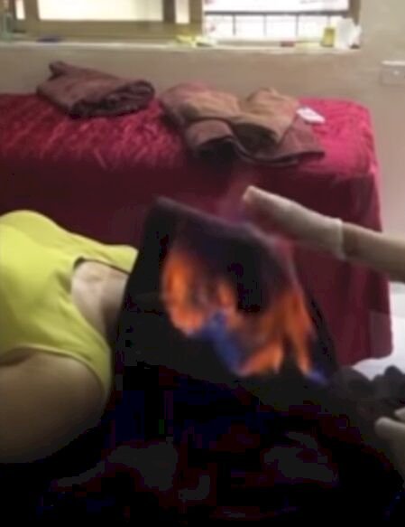 Nueva tendencia en Vietnam puede representar un peligro para las personas que se sometan a la misma (Foto: Youtube/CGTN)