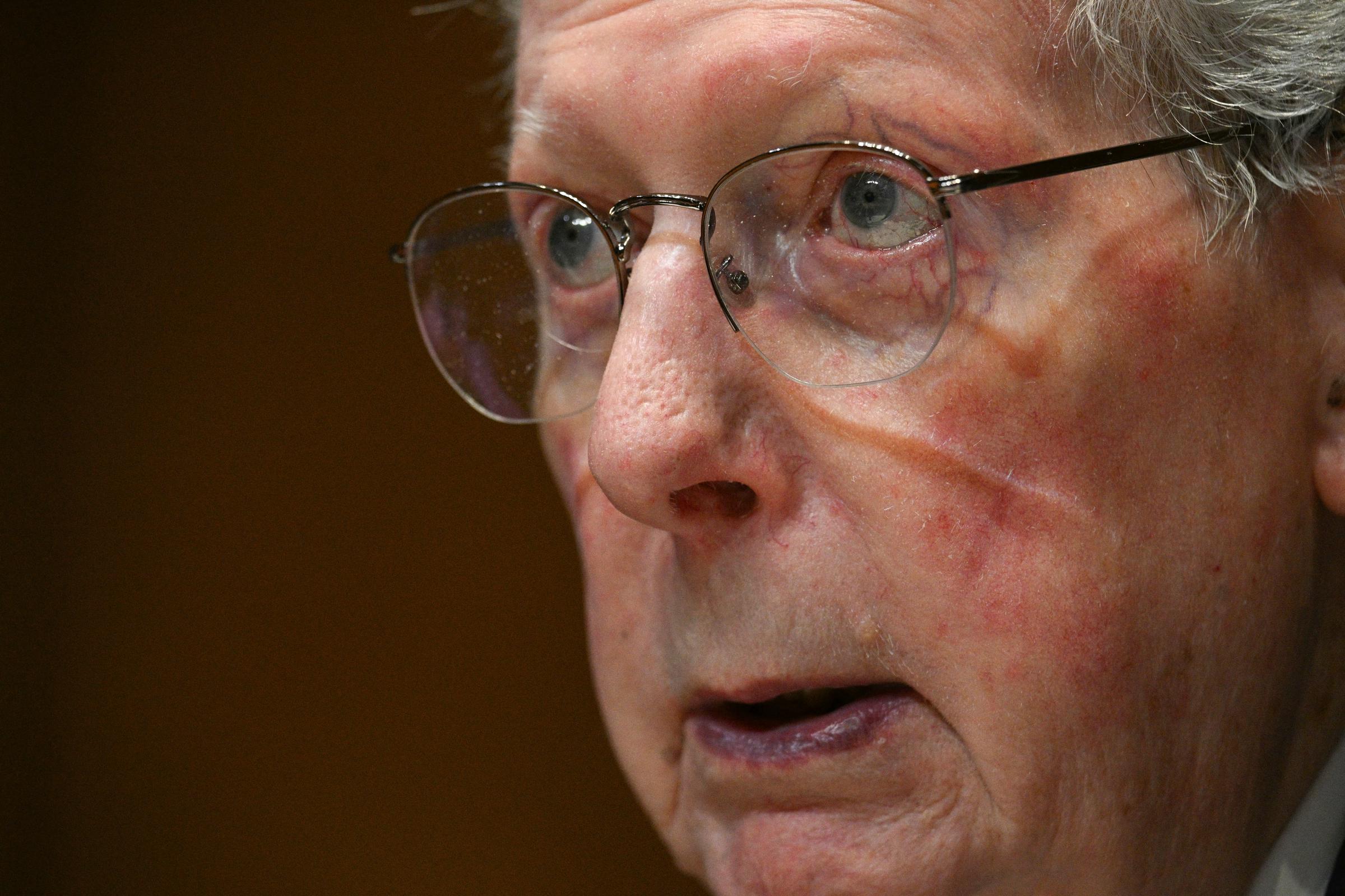 Sen. Mitch McConnell's office says he is continuing to improve while recovering in the hospital. However, it has not said what caused the medical emergency that led to his hospitalization. | Source: Getty Images